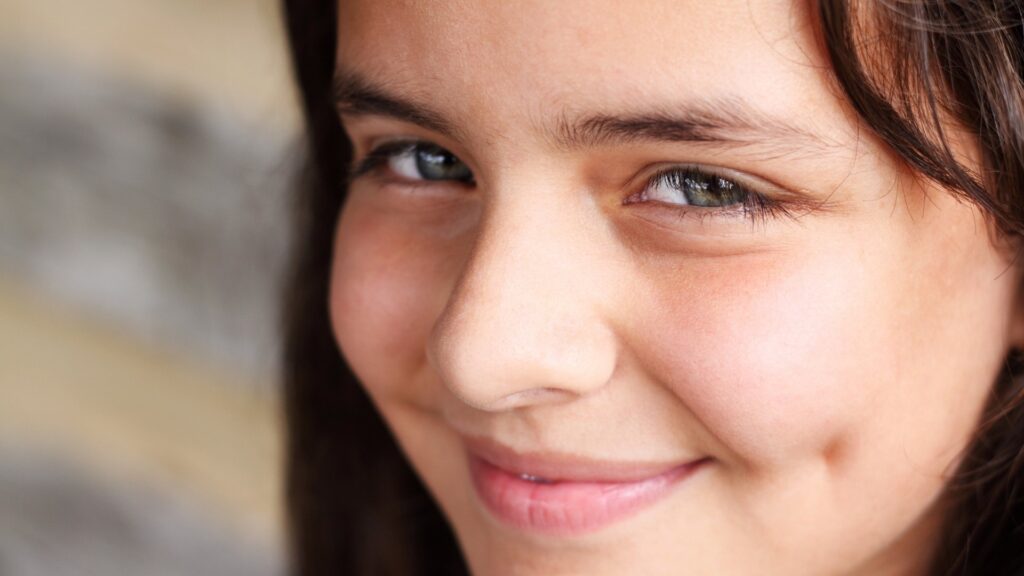 Dimples