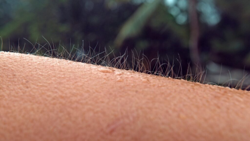 Goosebumps